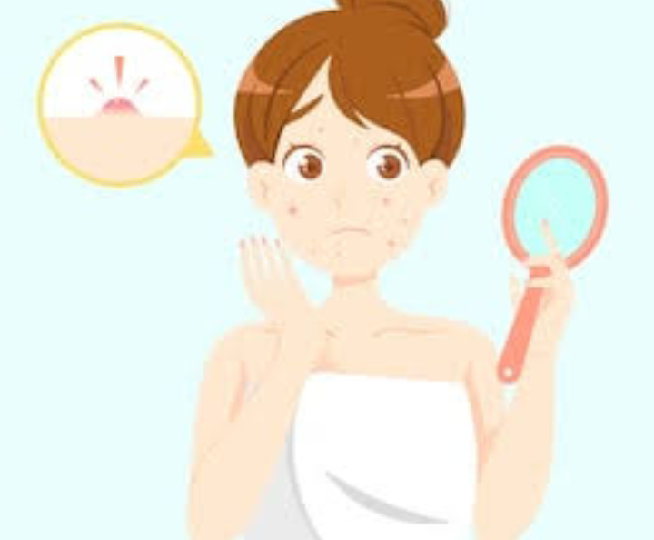 touching face can lead to pimples